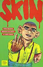 Skin